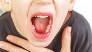 Đừng Coi Thường Viêm Họng Ở Trẻ Nhỏ - TRƯỜNG MẦM NON VOI CON